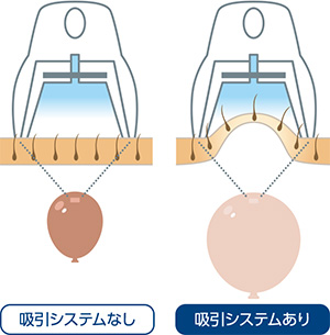 吸引アシストシステム