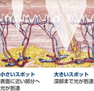HSハンドピース